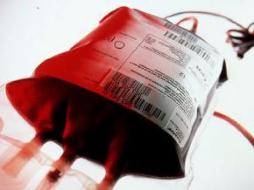 Yes, blood donations are paid in Cameroon