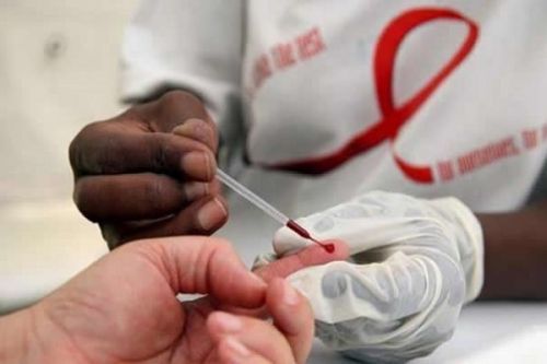 HIV/AIDS: Cameroon records 37,000 new cases in 2020