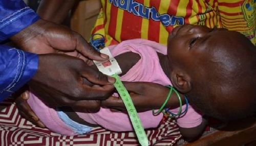 Santé : le Cameroun veut réduire de 50 % l’exposition des populations aux maladies dues à la mauvaise alimentation