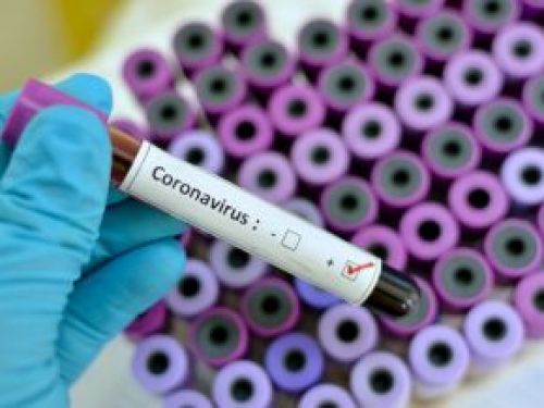Cameroon confirms the first case of coronavirus