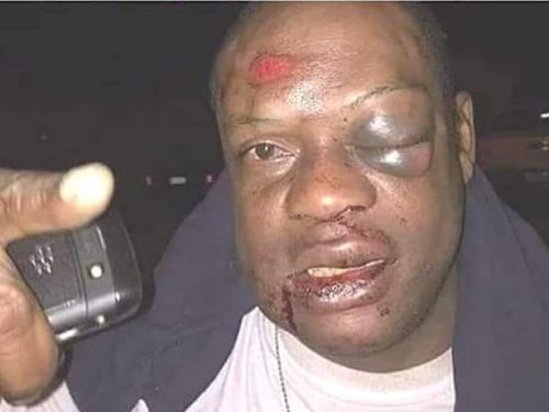 Non, la garde rapprochée du chef de l&#039;Etat camerounais n&#039;a pas tabassé cet homme sur la photo